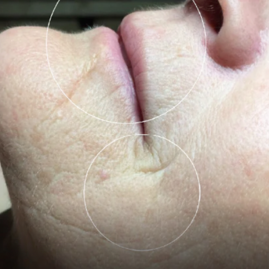 DEEP ANTI-AGING & VOLUME