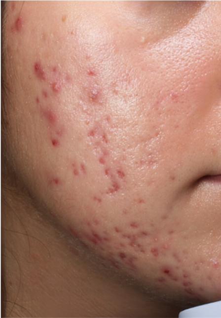 ACTIVE BREAKOUTS