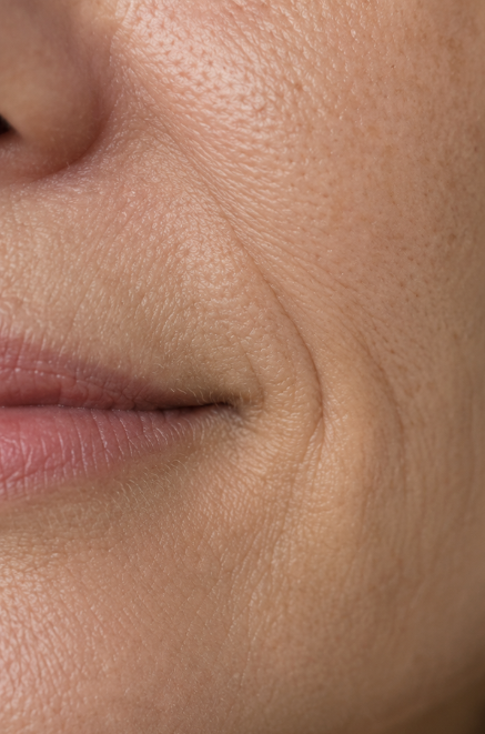 DEEP ANTI-AGING & VOLUME